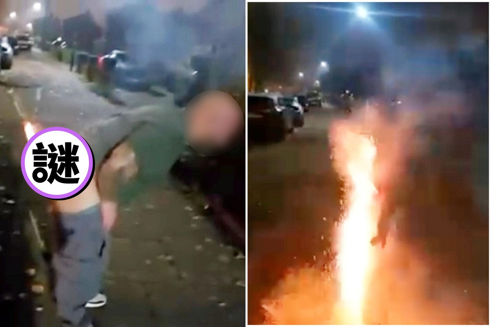 白癡不分國界！沖天炮插臀部「菊花爆開」　朋友不知嚴重性還大笑