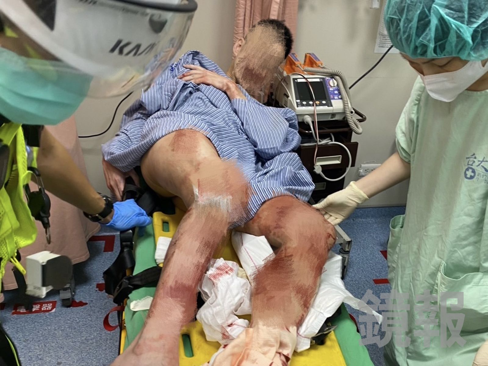 狂砍連襟30多刀!陽明交大教授中彈送醫 救治畫面曝光