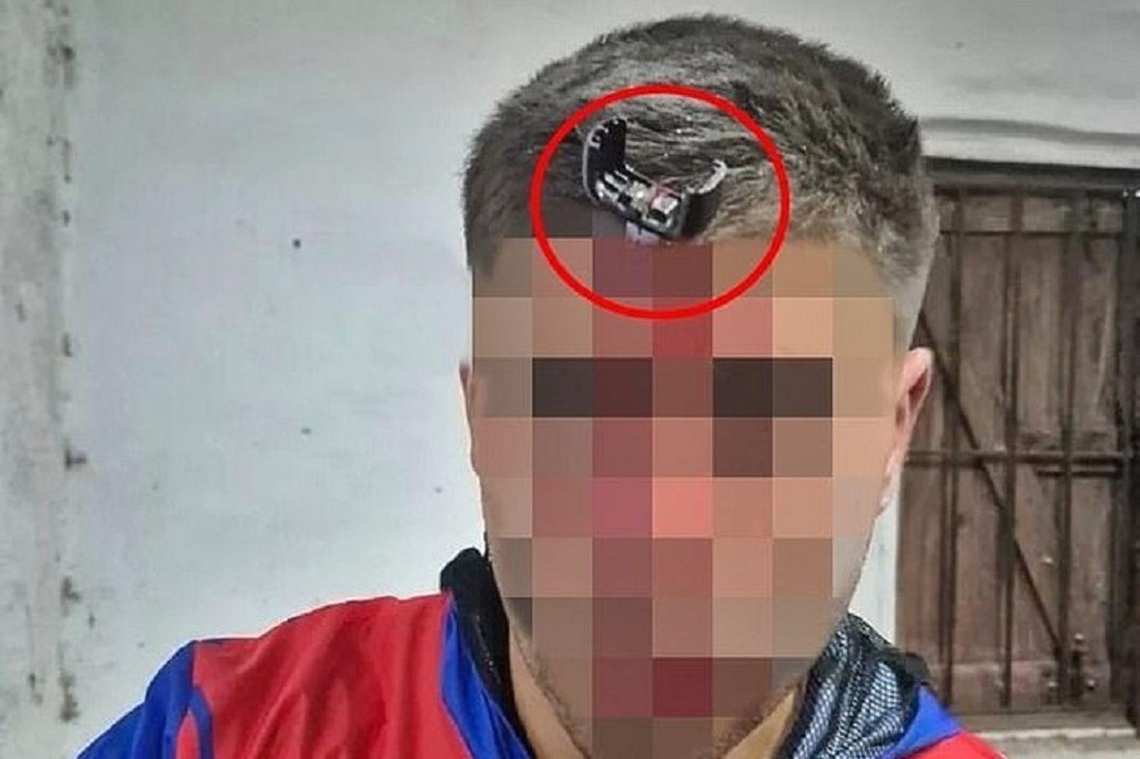 球員看女兒球賽變「集體鬥毆」　車鑰匙是凶器！直插他額頭超驚悚