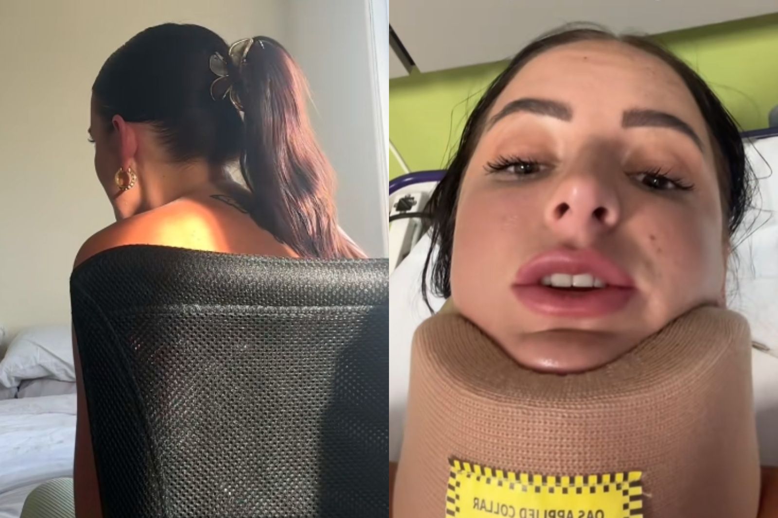 22歲女「頭戴鯊魚夾」出車禍！後腦杓遭重擊險丟命　醫揭隱形殺手