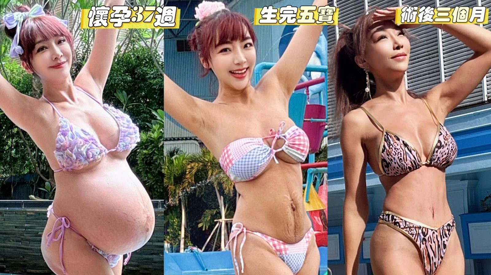 李宓分享懷孕、產後與手術後身材變化。翻攝李宓臉書