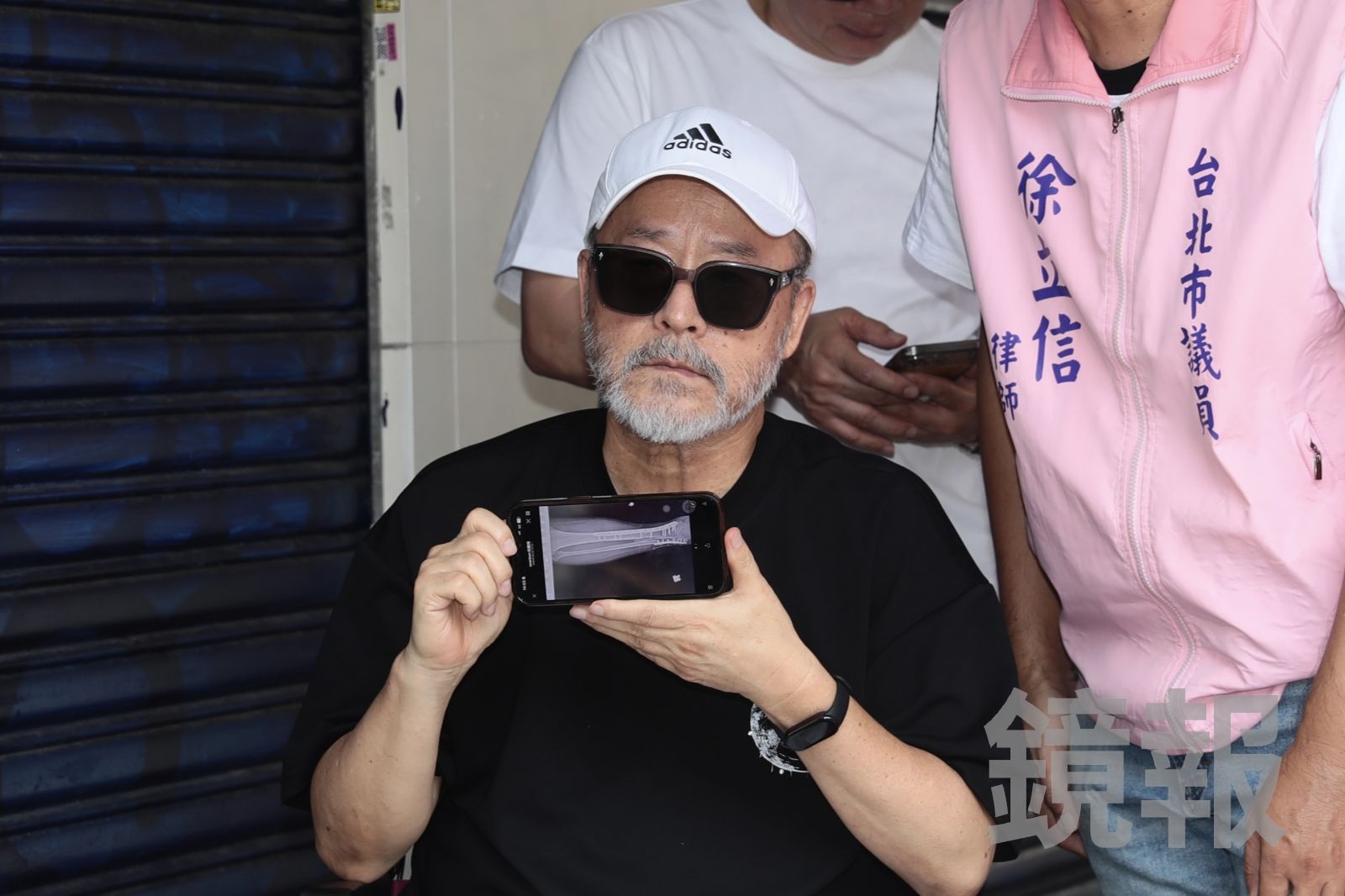 獨家/68歲資深男星摔斷腿2個月傷口感染流膿 遭醫生「緊急扣留」再度動刀!妻心力交瘁曝現況