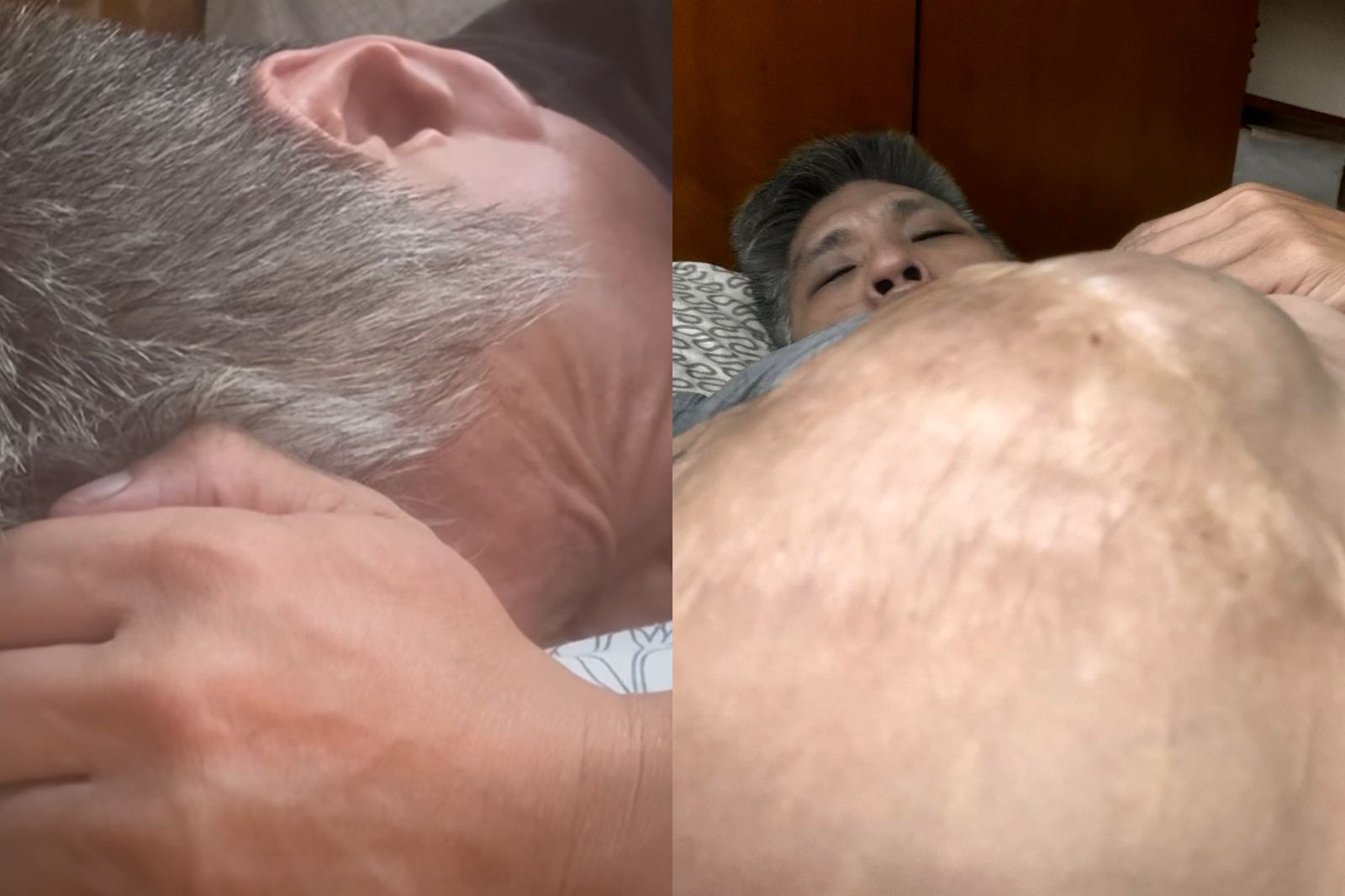 46年前分割手術成功…連體嬰弟忠義「腹腫如球」暫停活動　痛苦畫面曝光