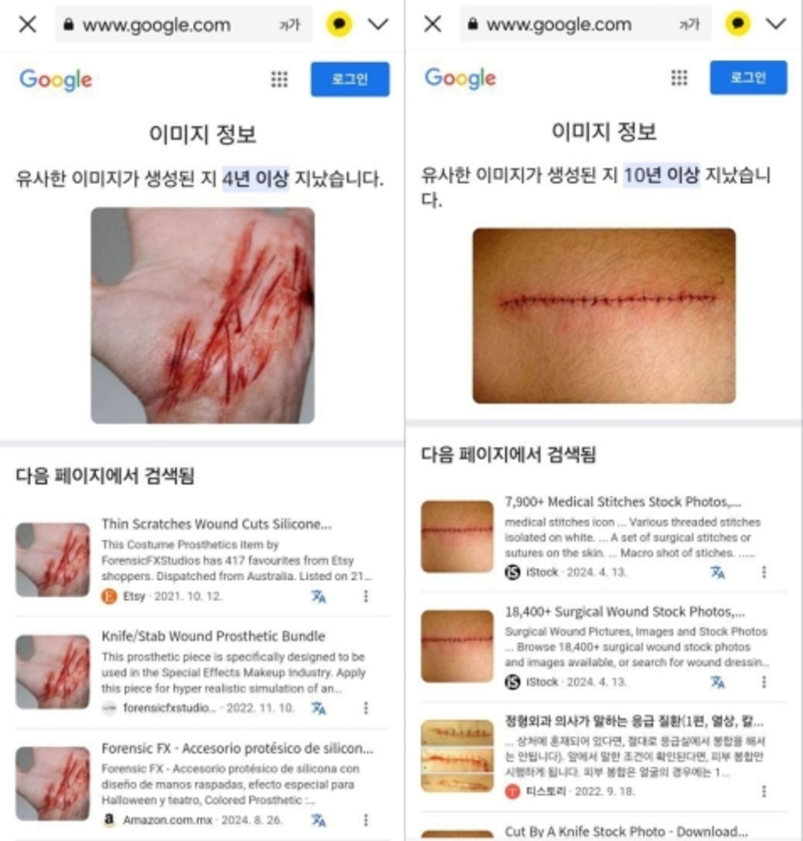 金秀賢公司強調所謂的驗傷照,就是網路下載的圖片。翻攝NAVER