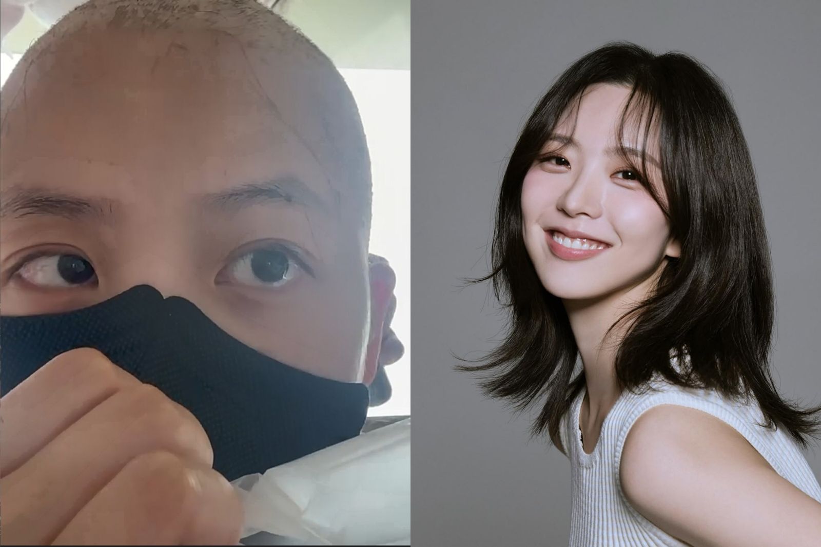 女偶像罹血癌治療3個月　勇敢曬落髮照吐最新病況