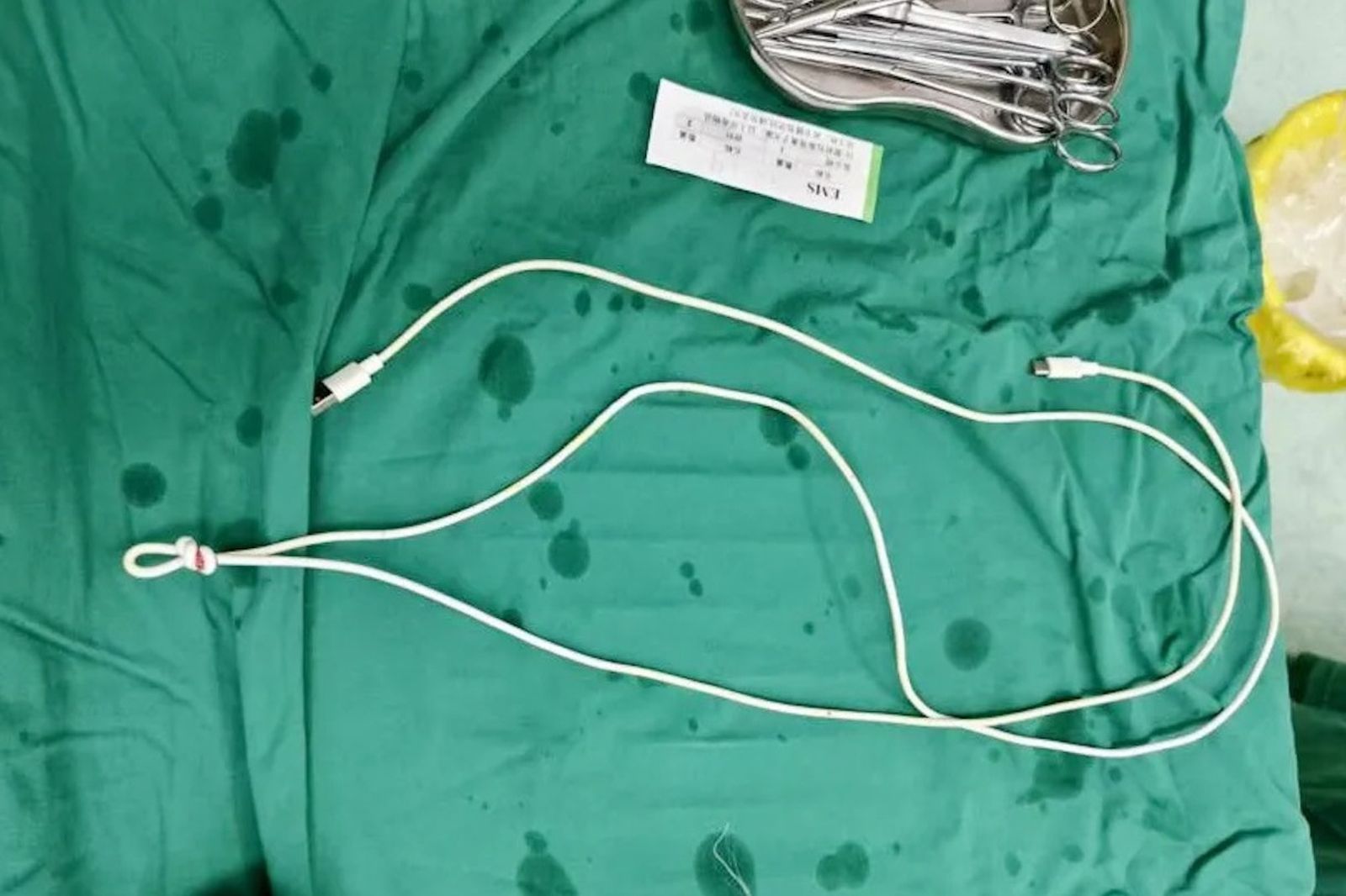 49歲男下腹痛到快炸開!醫一看驚呆:尿道塞80公分充電線