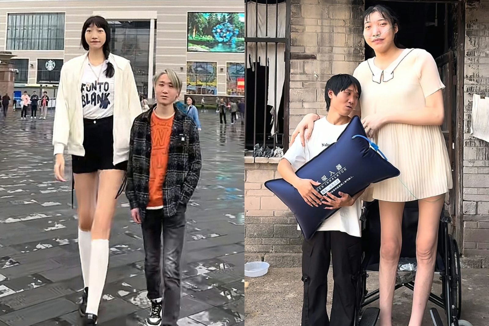 中國「巨人網紅」小玥驚傳病逝,年僅26歲。翻攝抖音
