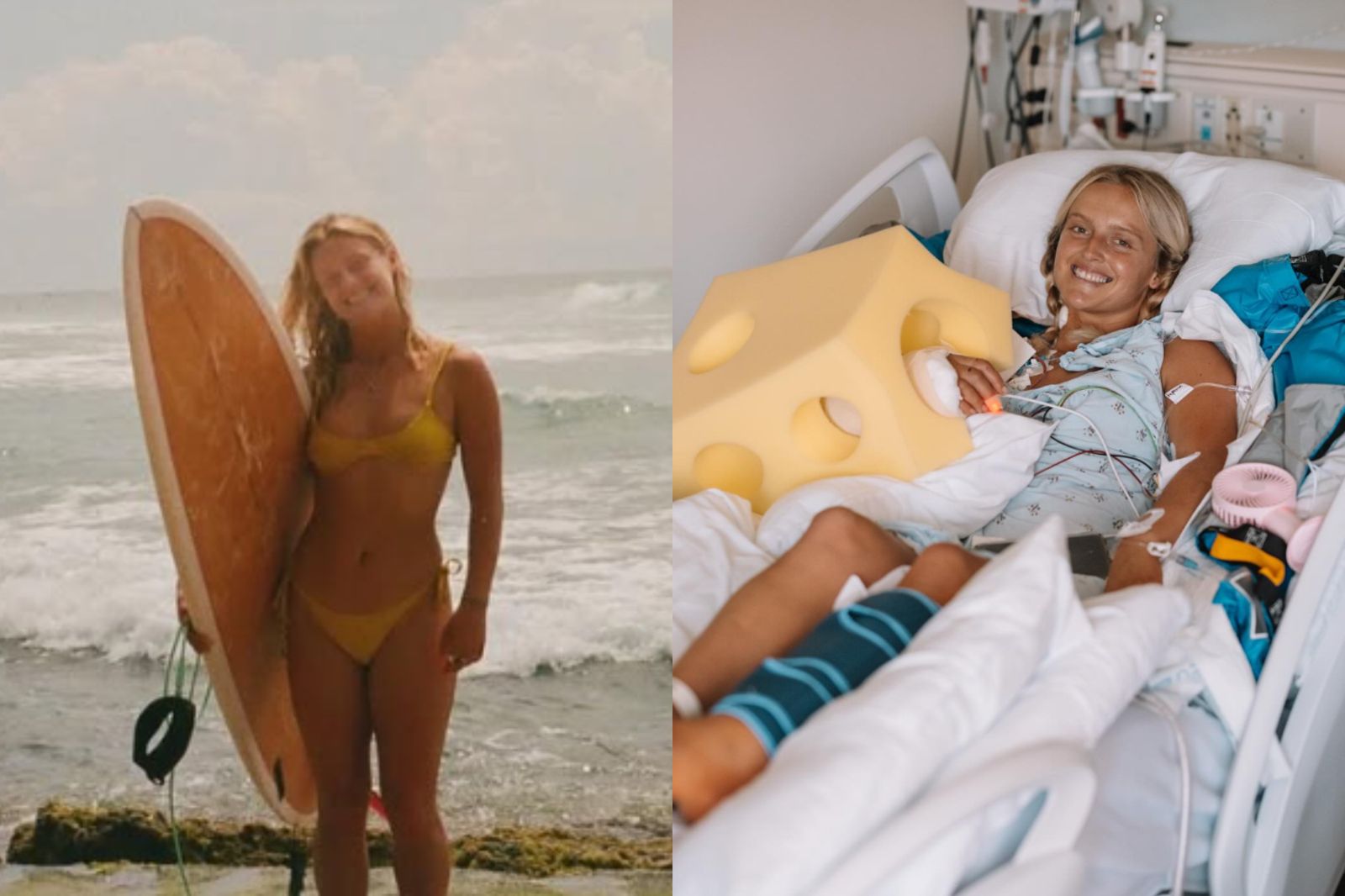 24歲衝浪教練遭火車撞「手臂消失」！她手術醒來盼重投海洋懷抱