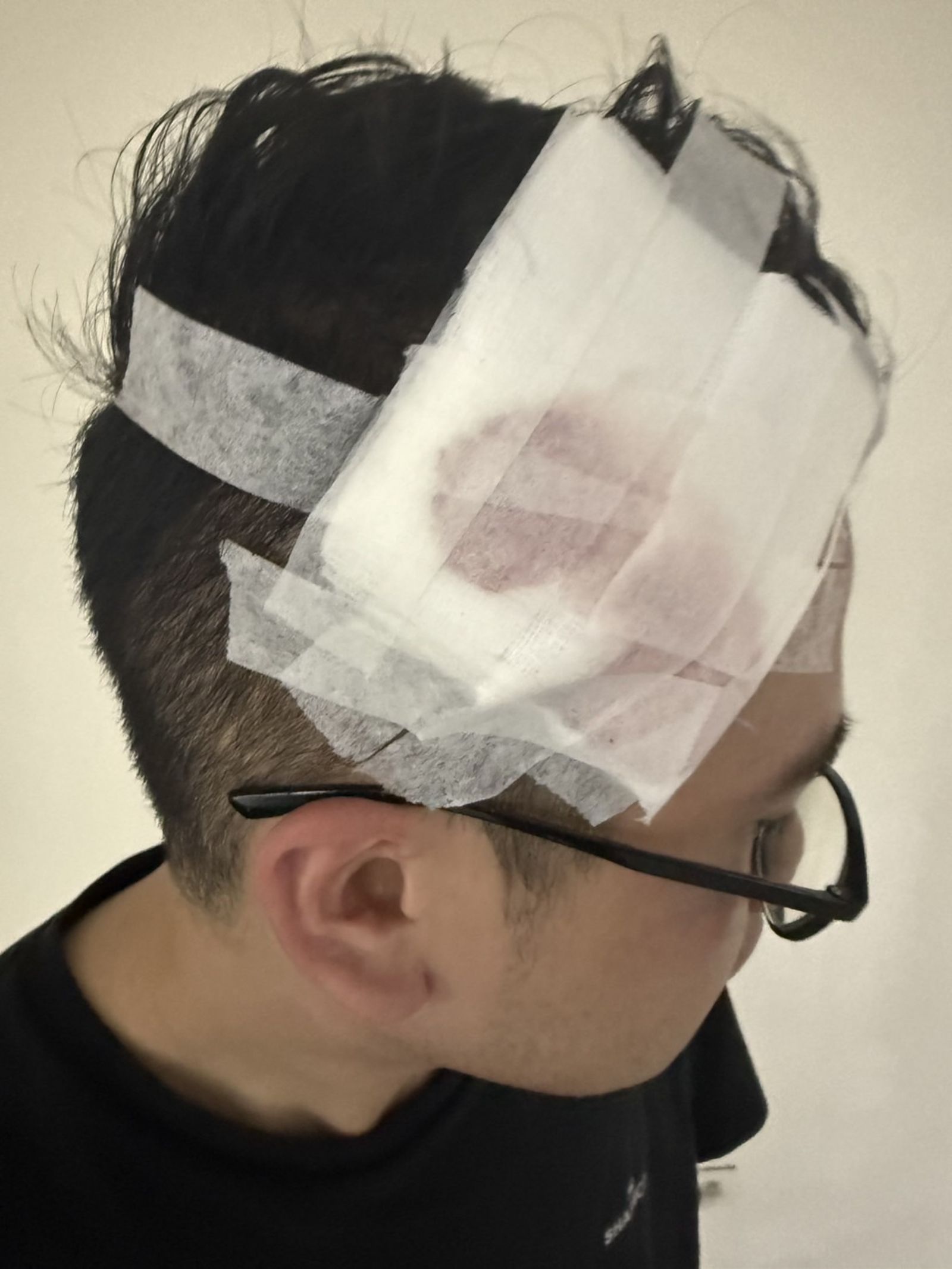 警員沈聖捷頭部傷勢。警方提供