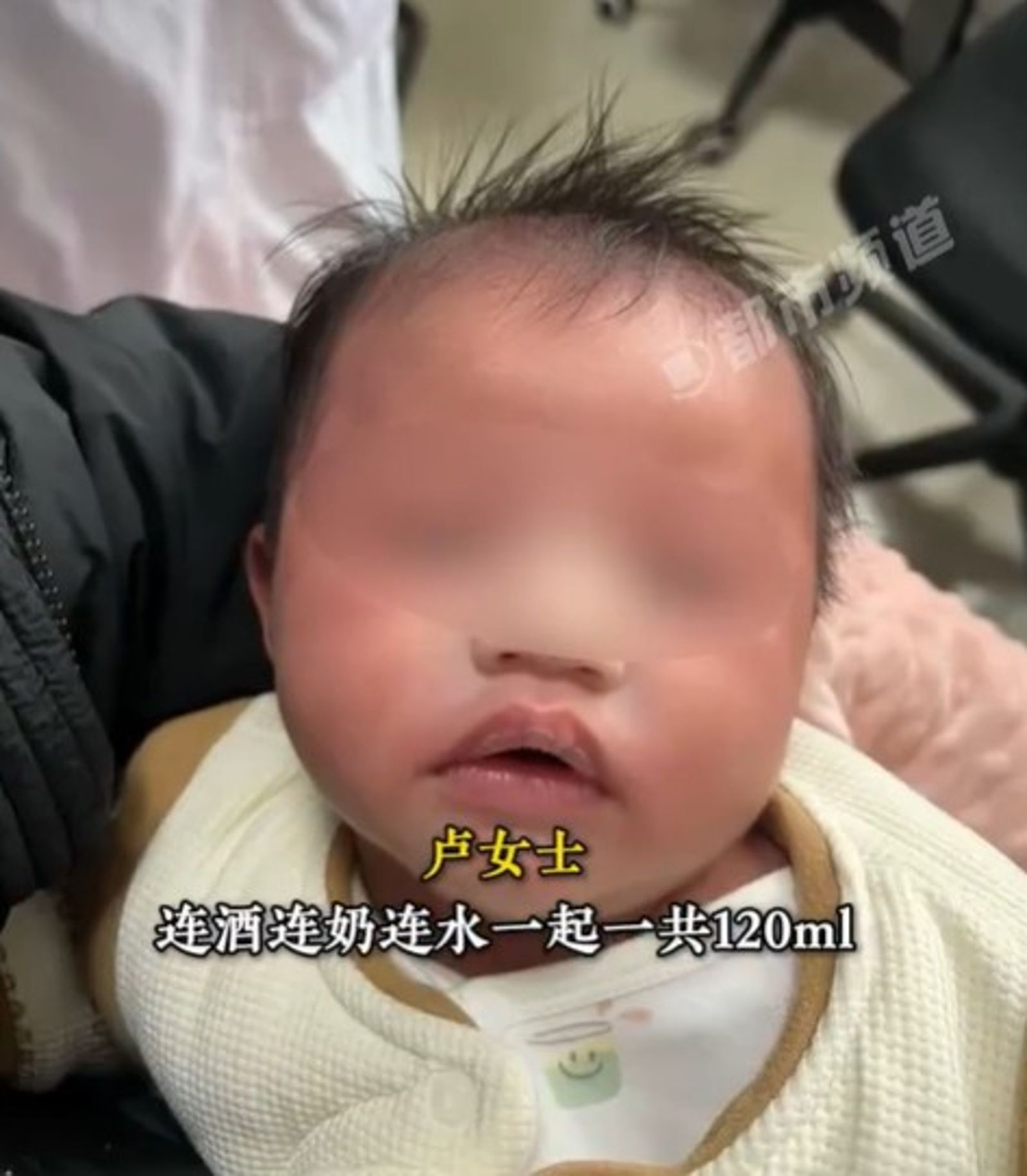 嬰兒喝了奶酒後全身泛紅。圖／翻攝自微博