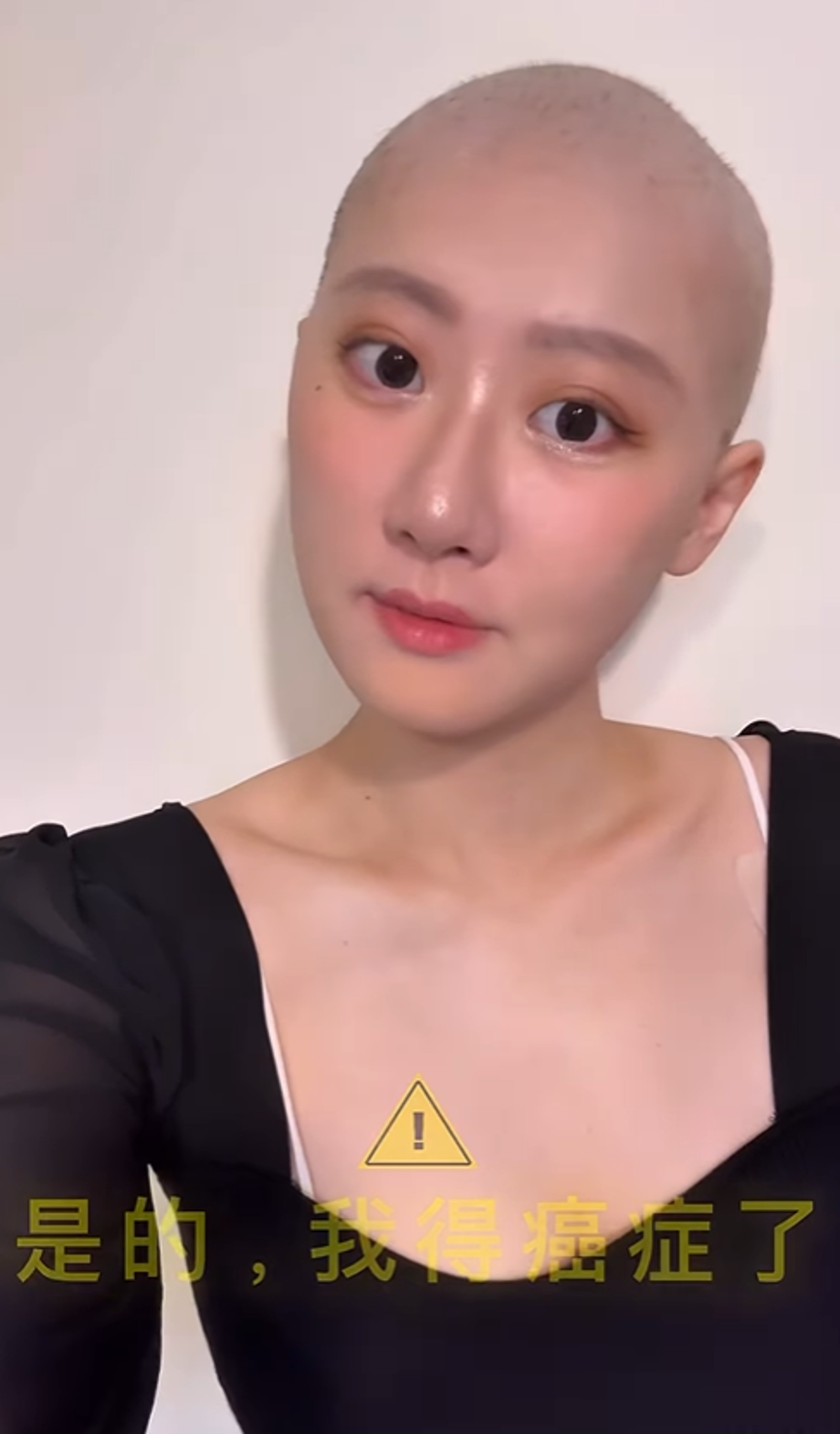 林茉晶在IG上公開抗癌過程。翻攝林茉晶IG