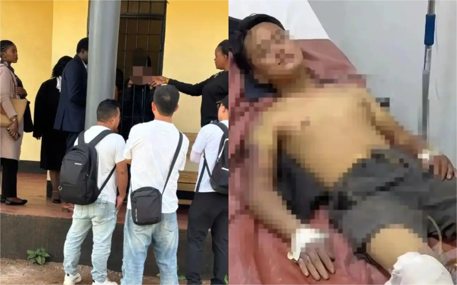 非洲拍片變惡夢！網紅談合作竟遭綁架電擊「打斷雙腿」　凶手超離譜下場曝