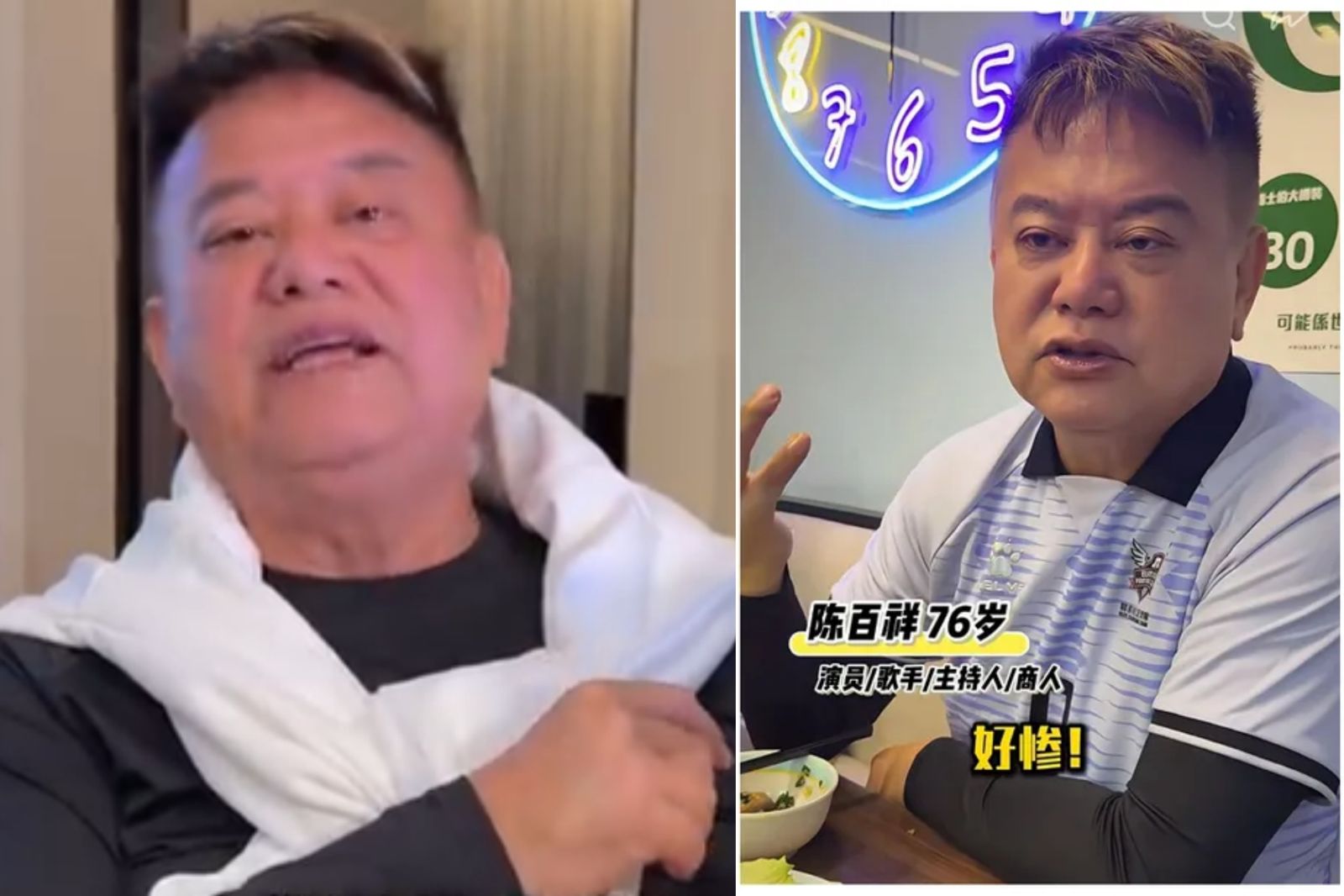 76歲港星陳百祥認「血管爆了」！大腿整片瘀青照曝光　本人親揭健康真相