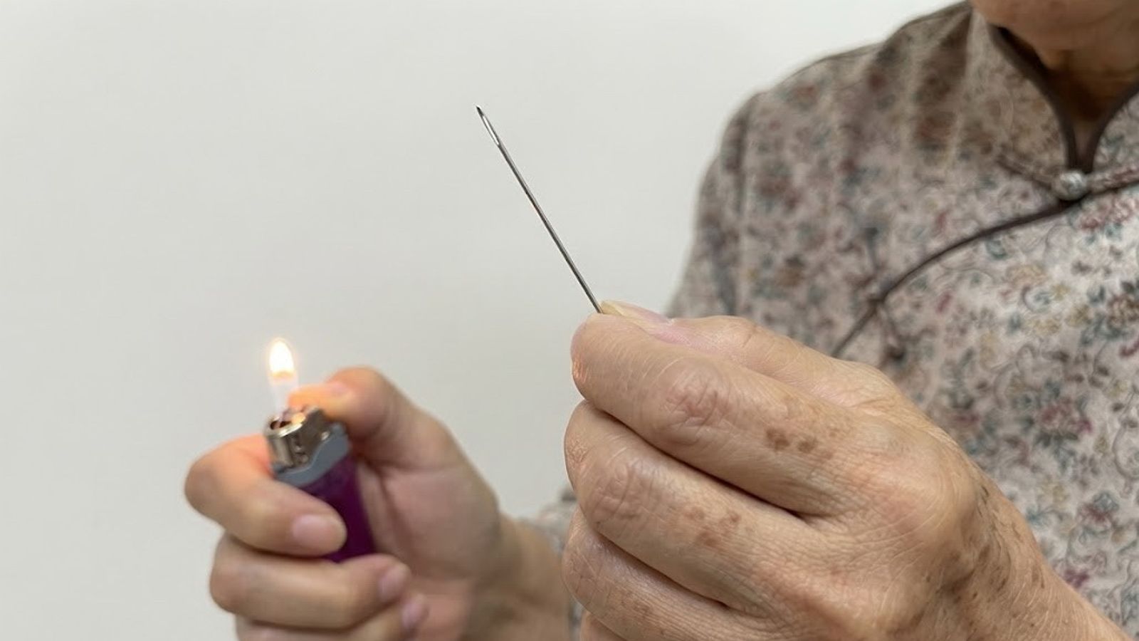 「火烤縫衣針」古法出招!80歲嬤戳破屁股膿包出事了 醫師見這狀況嚇爛急開刀