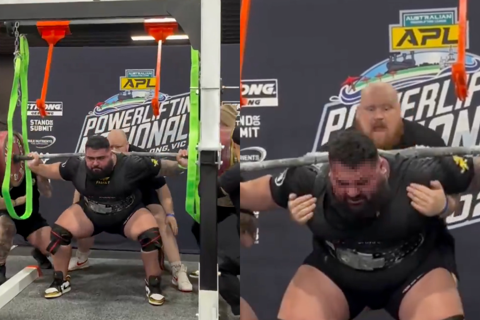 用力過度！澳舉重選手深蹲410kg槓鈴　「頭部噴血」滿臉鮮紅畫面曝