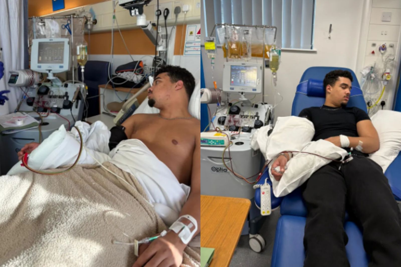 17歲少年感冒後「雙腳發紫」！不放心醫師診斷問ChatGPT揪出「這罕病」