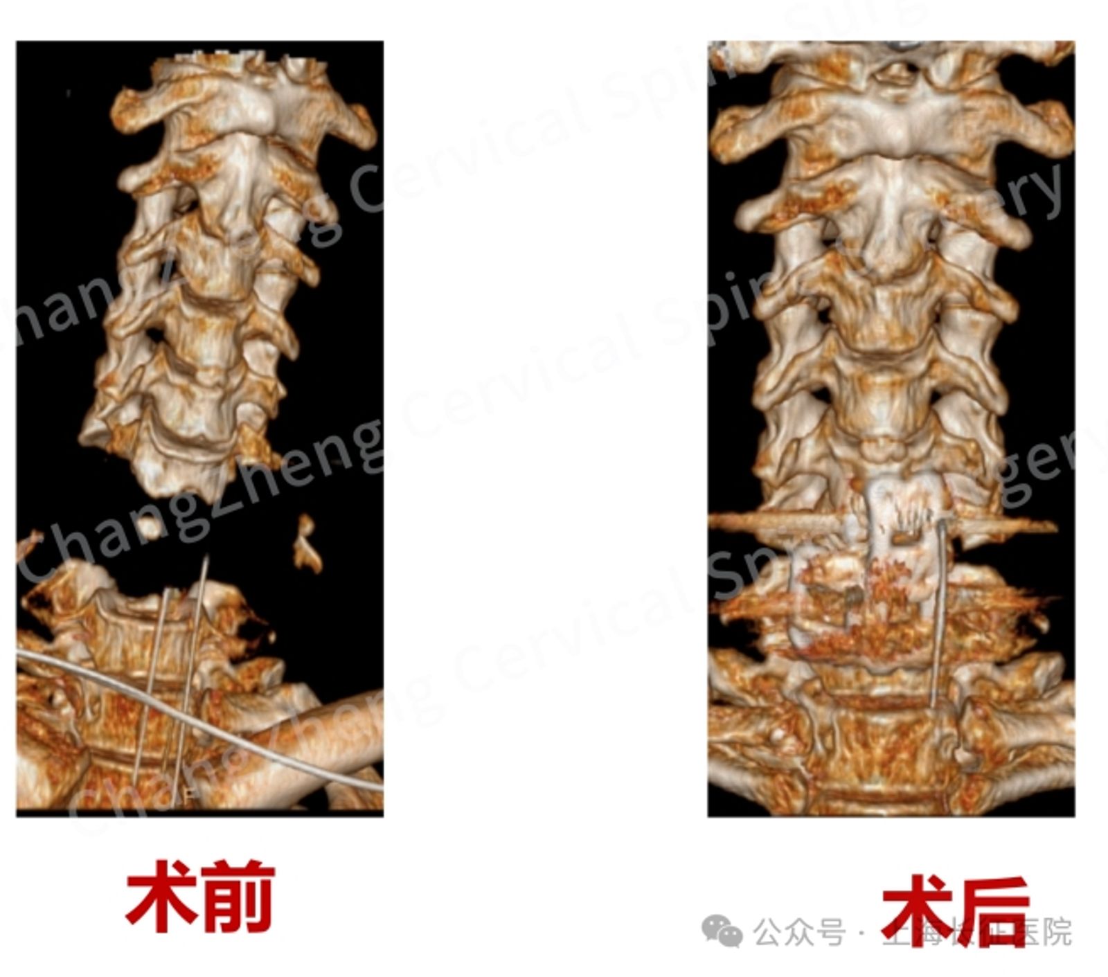 術前術後照。圖／百度