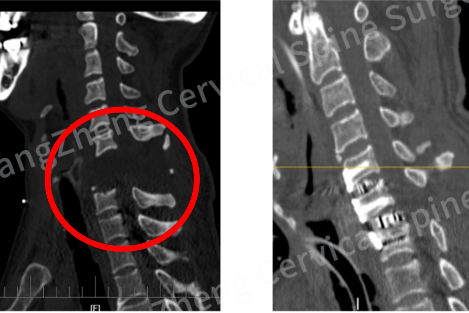 脖子遭重擊「身首斷離」瀕死　醫生竟把他救活了！