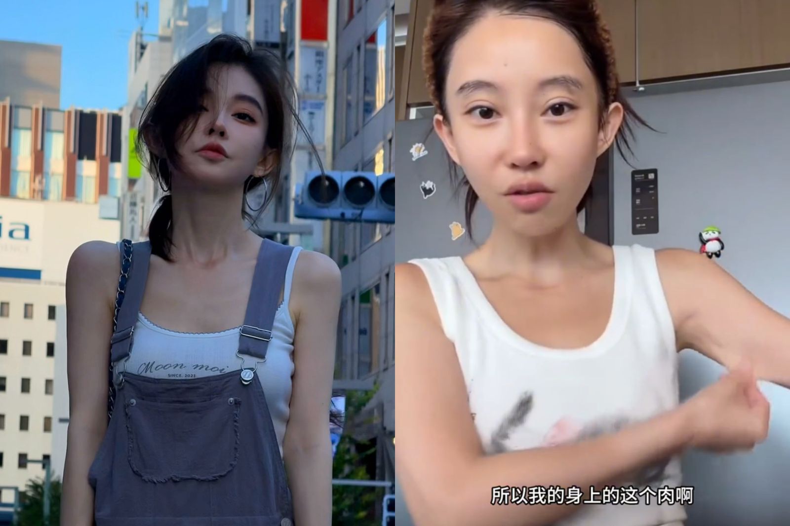 癌症復發後又暴瘦25公斤　「中國第一網紅」馮提莫露「全皺摺肚皮」闢謠